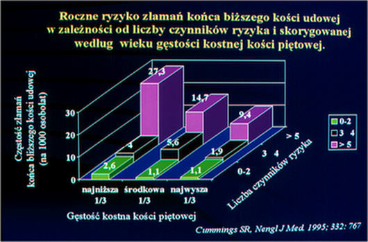 Roczne ryzyko zama koca bliszego koci udowej